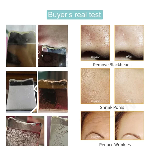 Ultrasonic Skin Scrubber Peeling Blackhead Remover Deep Face Cleaning Ultrasonic Ion Ance Pore Cleaner Facial Shovel Cleanser - Image 6