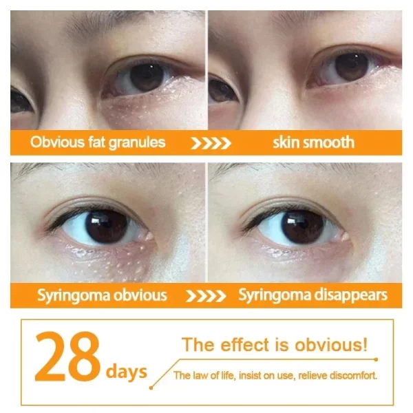 Fat Granules Remover Eye Cream Anti-Puffiness Anti Inflammatory Firm Cream Reduce Dark Circles Fade Fine Lines Repair Barrier Sk - Image 5