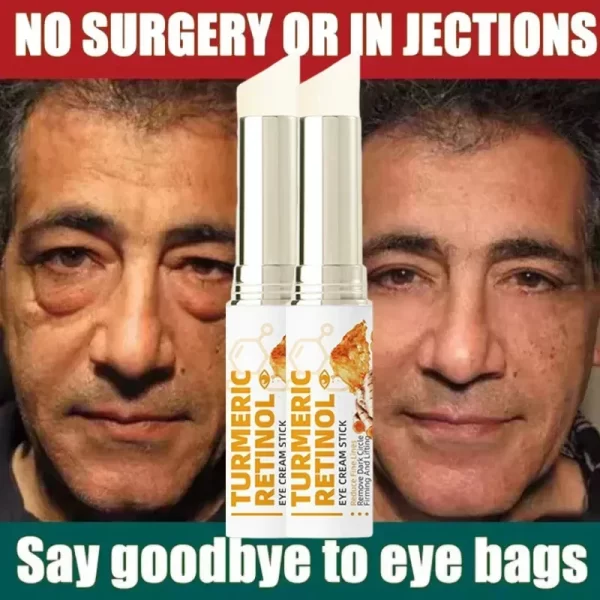 Instant Eye Bag Remove Eye Cream Anti Fat Particles Dark Circles Puffiness Fade Fine Lines Lift Brighten Korean Beauty Eye Care - Image 4