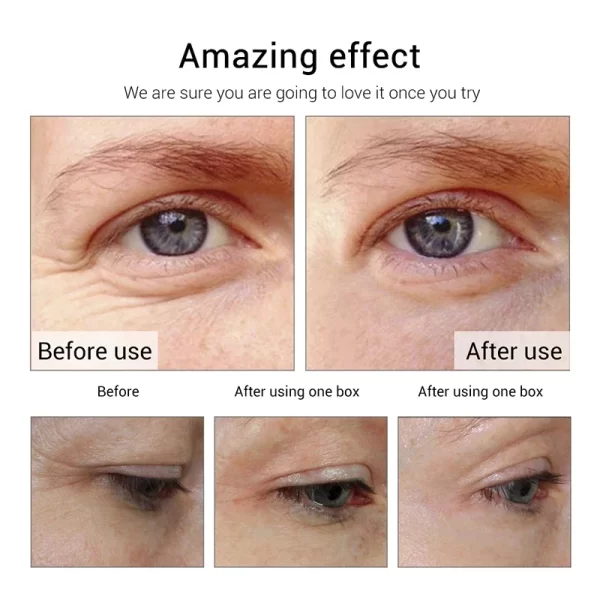 1PCS Peptides Ageless Eye Cream Hyaluronic Acid Instantly Serum Essence Gel for Firming Wrinkles Whitening Puffy Eye Care - Image 5