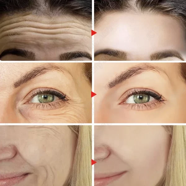 Original Remove Wrinkle Face Set Firming Lifting Anti-Aging Serum  Fade Fine Lines Eye stick Improve Puffiness Korean Skin Care - Image 3
