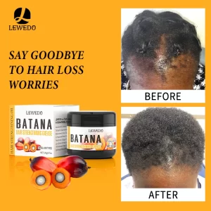 Fast Hair Growth Oil Africa Crazy Traction Alopecia batana Hair Mask Anti Hair Break Hair Strengthener Hair Loss Treatment Spray
