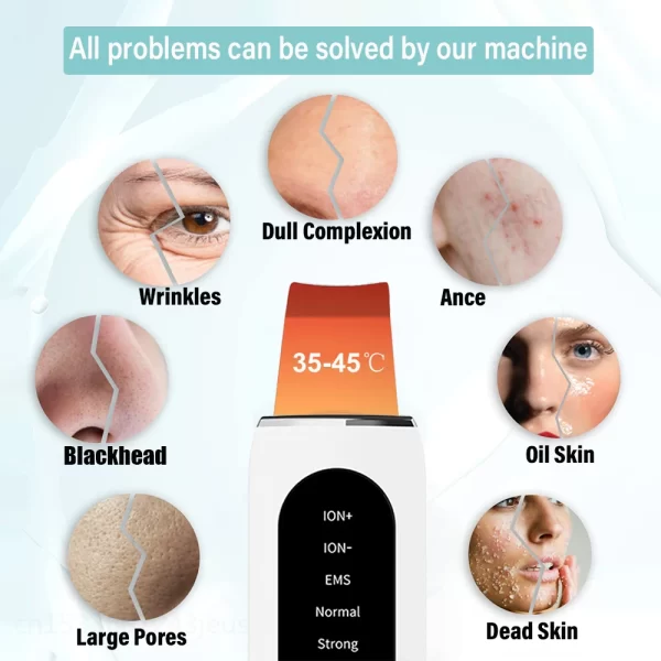 Ultrasonic Skin Scrubber Peeling Blackhead Remover Deep Face Cleaning Ultrasonic Ion Ance Pore Cleaner Facial Shovel Cleanser - Image 2