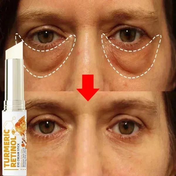 Instant Eye Bag Remove Eye Cream Anti Fat Particles Dark Circles Puffiness Fade Fine Lines Lift Brighten Korean Beauty Eye Care - Image 3