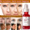 Pure Retinol Face Serum with Vitamin B3. Anti Aging Face Serum for Lines Wrinkles & Premature Sun Damage - Image 3