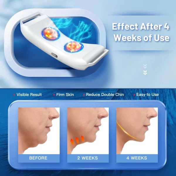 Vibration Chin-Up V Face Massager for Face EMS Facial Lifter Beauty Device Double Chin Remover V-Line Up Facelift Shaper Belt - Image 4