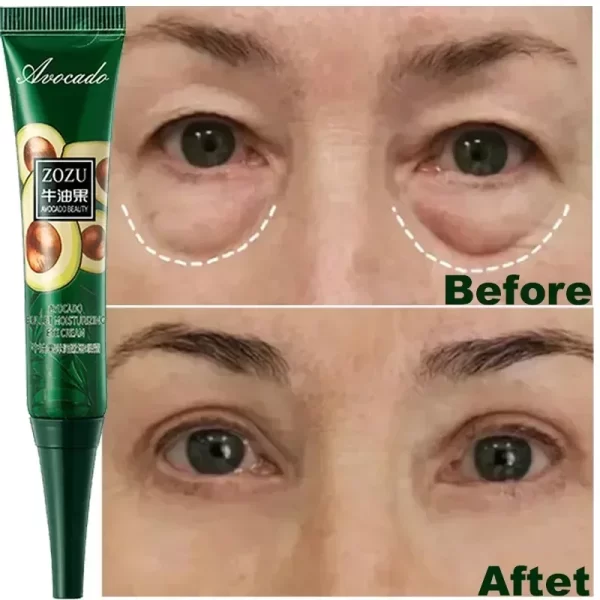 Anti Dark Circles Bags Instant Remove Wrinkles Eye Cream Puffiness Fade Eye Fine Line Tighten Whiten Under Eyes Skin Care New - Image 3
