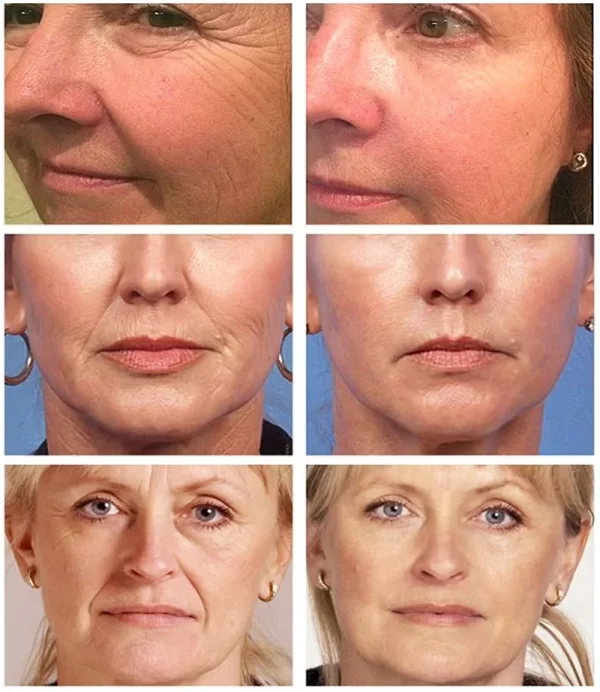 Pure Retinol Face Serum with Vitamin B3. Anti Aging Face Serum for Lines Wrinkles & Premature Sun Damage - Image 2