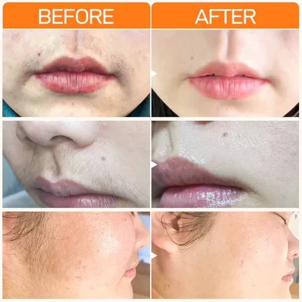 Joypretty Hair Removal Creams Fast Gentle Removal Skin Care Whitening  Clear Lip Hair Underarm Depilation Cream For Women Beauty - Image 5