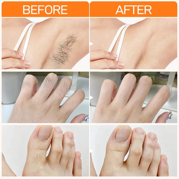 Joypretty Hair Removal Creams Fast Gentle Removal Skin Care Whitening  Clear Lip Hair Underarm Depilation Cream For Women Beauty - Image 6