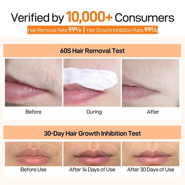 Joypretty Hair Removal Creams Fast Gentle Removal Skin Care Whitening  Clear Lip Hair Underarm Depilation Cream For Women Beauty - Image 3